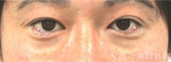 症例NO.12899のAFTER写真