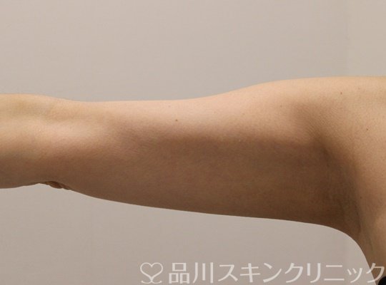 症例NO.73826のAFTER写真
