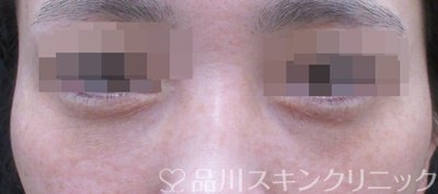 症例NO.69591のAFTER写真