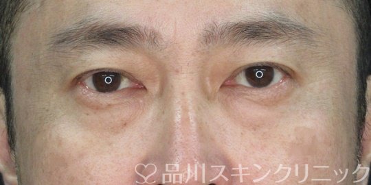 症例NO.72954のBEFORE写真
