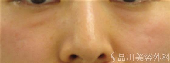 症例NO.59134のBEFORE写真