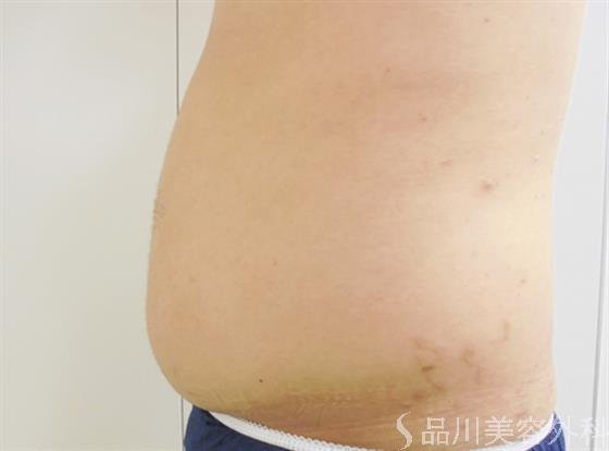 症例NO.24274のBEFORE写真