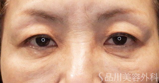 症例NO.65673のBEFORE写真