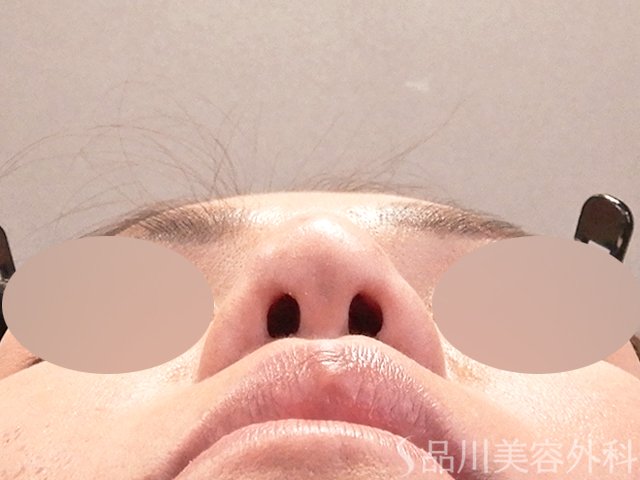 症例NO.67918のAFTER写真