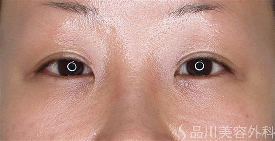 症例NO.59616のAFTER写真