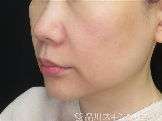 症例NO.59157のBEFORE写真