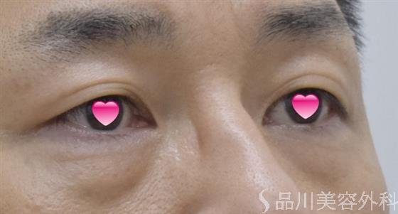 症例NO.50256のBEFORE写真