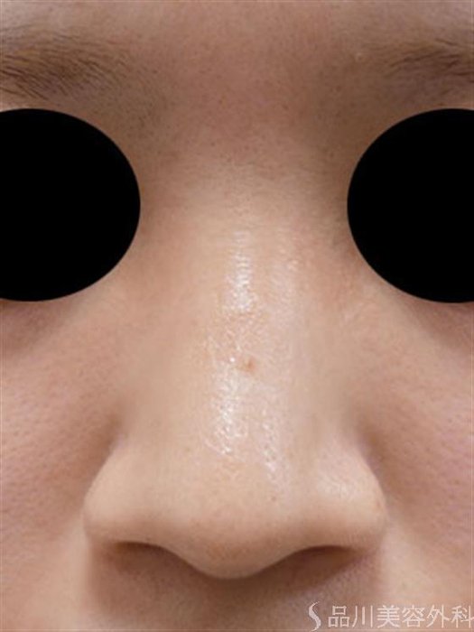 症例NO.54273のBEFORE写真