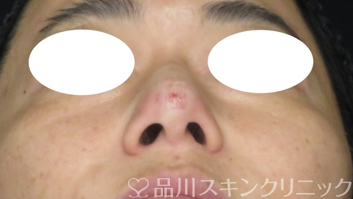 症例NO.70192のAFTER写真