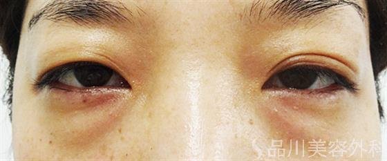 症例NO.25302のBEFORE写真