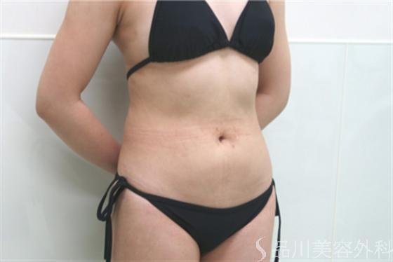 症例NO.16984のAFTER写真