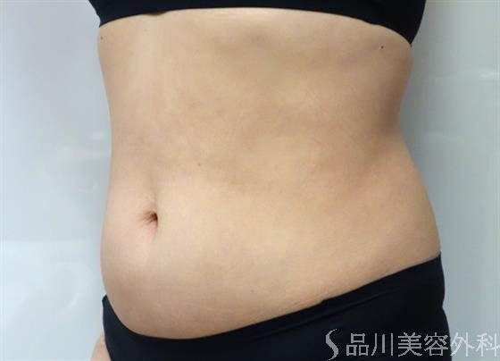 症例NO.40653のAFTER写真