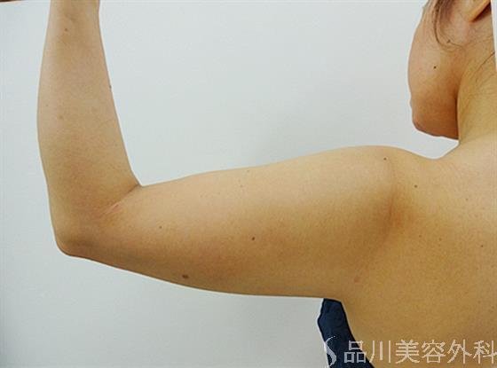 症例NO.25303のBEFORE写真