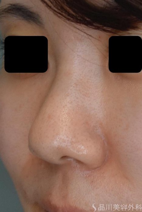 症例NO.50383のBEFORE写真
