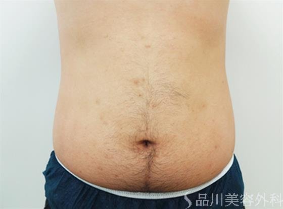 症例NO.24274のAFTER写真