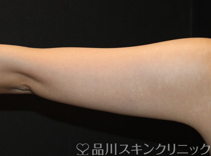 症例NO.65478のAFTER写真