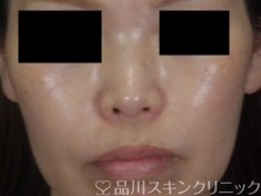 症例NO.73968のAFTER写真