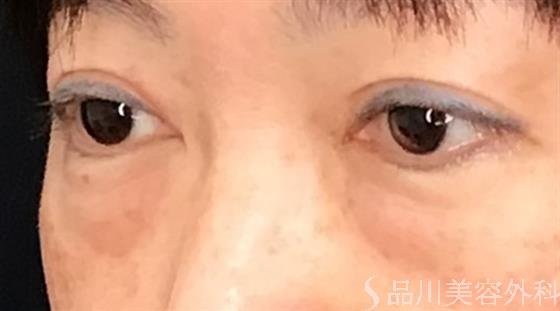 症例NO.59626のBEFORE写真