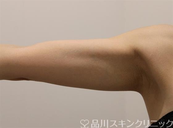症例NO.47483のAFTER写真
