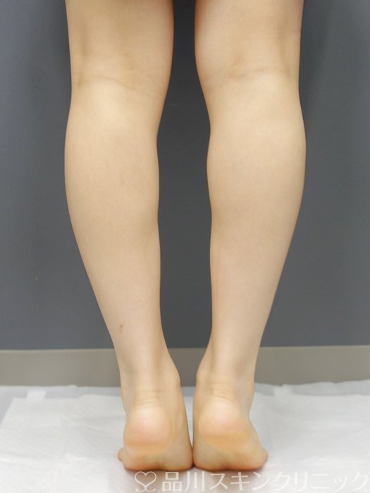 症例NO.73247のAFTER写真