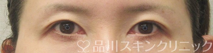 症例NO.71138のBEFORE写真