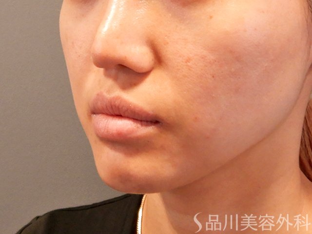 症例NO.70029のBEFORE写真