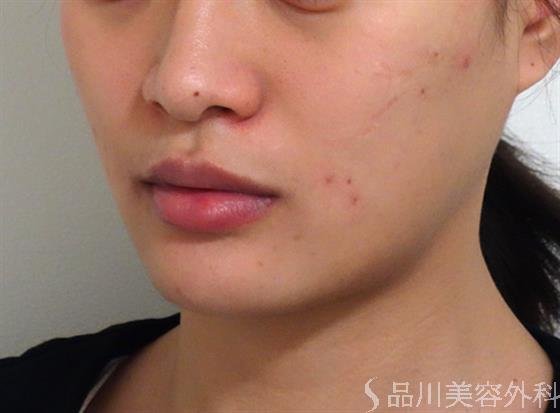 症例NO.37981のBEFORE写真