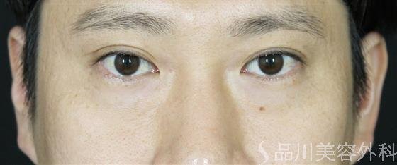 症例NO.57088のBEFORE写真
