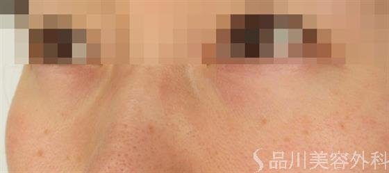 症例NO.50275のBEFORE写真