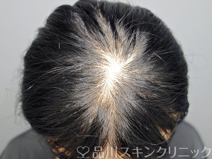 症例NO.73646のBEFORE写真