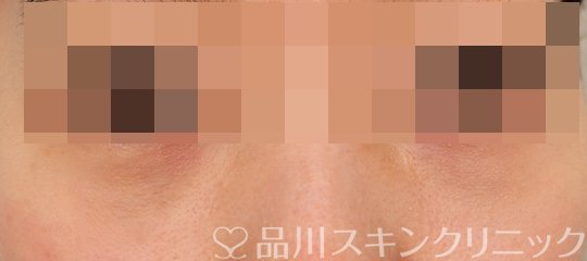 症例NO.73827のAFTER写真