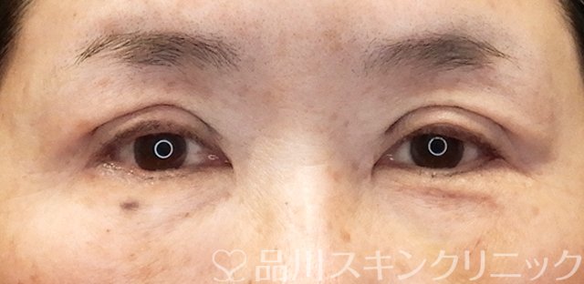症例NO.67257のAFTER写真
