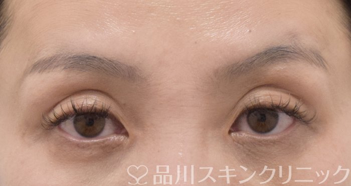 症例NO.70234のBEFORE写真