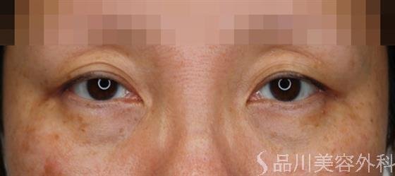 症例NO.50623のBEFORE写真