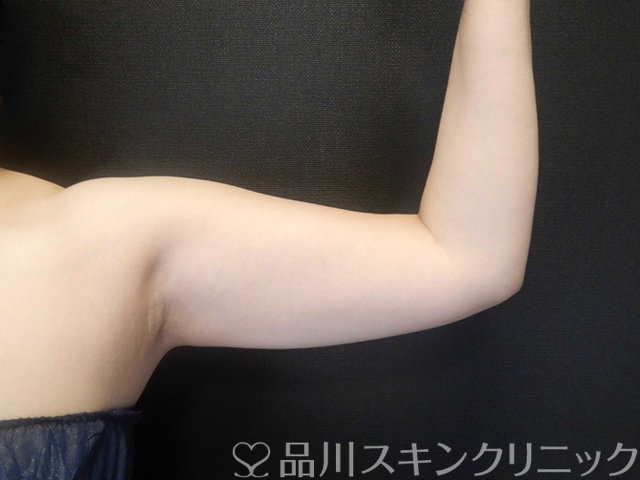 症例NO.66305のBEFORE写真