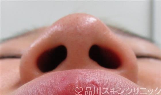 症例NO.34269のBEFORE写真