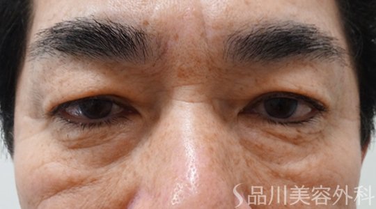 症例NO.69799のBEFORE写真