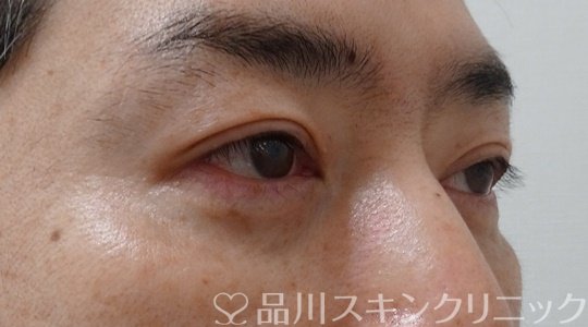 症例NO.70784のAFTER写真