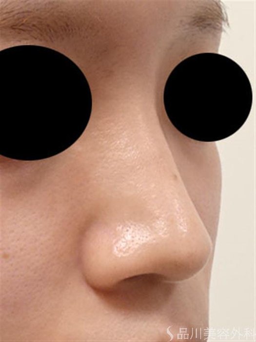 症例NO.54273のBEFORE写真