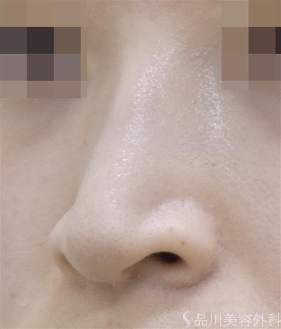 症例NO.50388のBEFORE写真