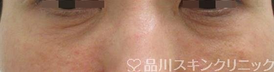 症例NO.28267のBEFORE写真