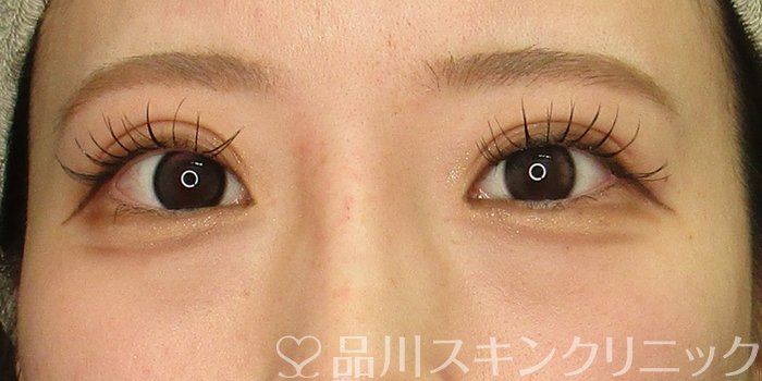 症例NO.73550のAFTER写真