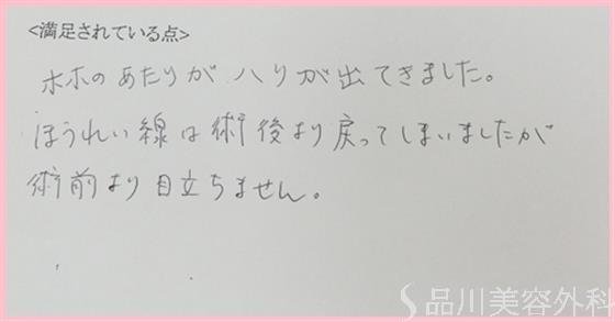 症例NO.27927のAFTER写真