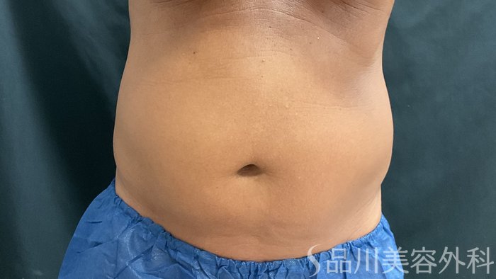 症例NO.75369のBEFORE写真