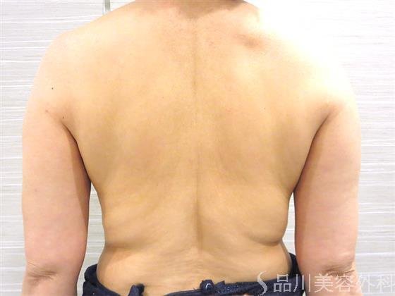 症例NO.22901のBEFORE写真