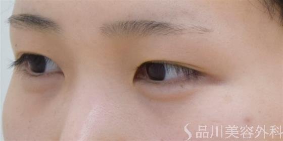 症例NO.60919のBEFORE写真