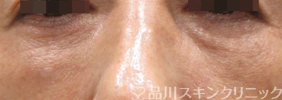 症例NO.25754のAFTER写真