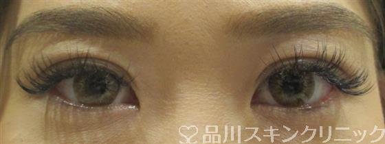 症例NO.30286のAFTER写真