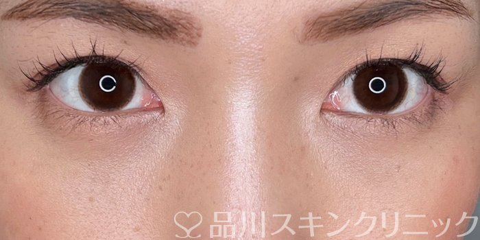 症例NO.70040のAFTER写真