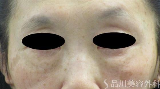 症例NO.47259のBEFORE写真